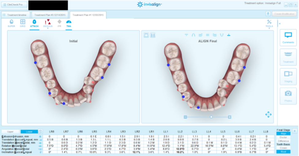 Clincheck's Reviewed by an orthodontist through Aligner Concierege ...